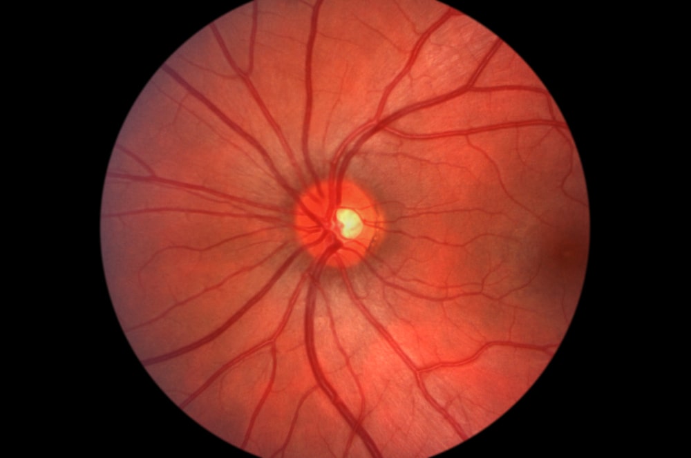Read more about the article A Look At Common Retina Disorders